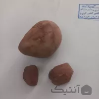 سه قطعه سنگ راف یاقوت